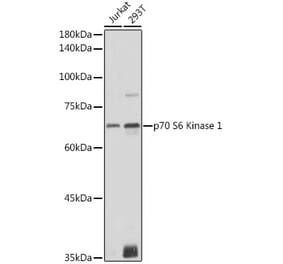 Western Blot - Anti-S6K1 Antibody (A90988) - Antibodies.com
