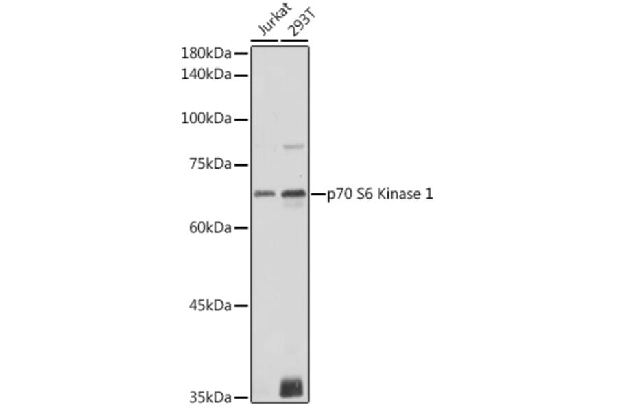Western Blot - Anti-S6K1 Antibody (A90988) - Antibodies.com