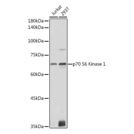 Western Blot - Anti-S6K1 Antibody (A90988) - Antibodies.com