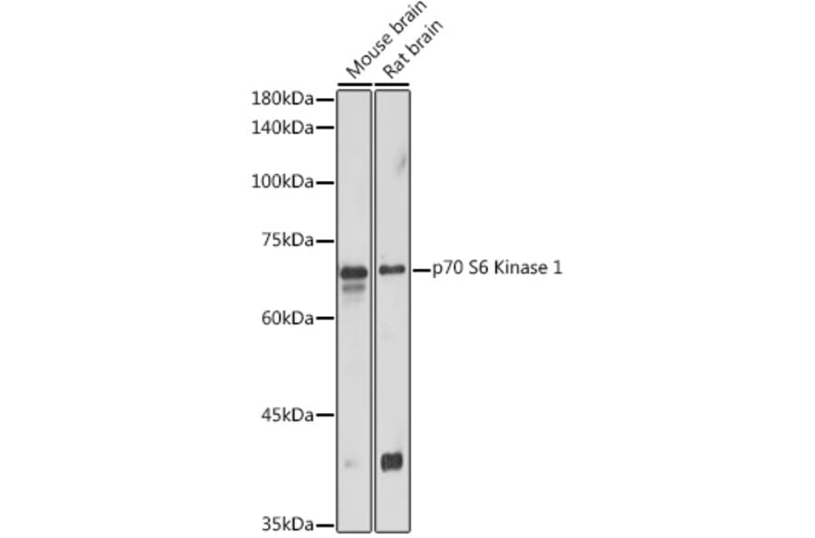 Western Blot - Anti-S6K1 Antibody (A90988) - Antibodies.com