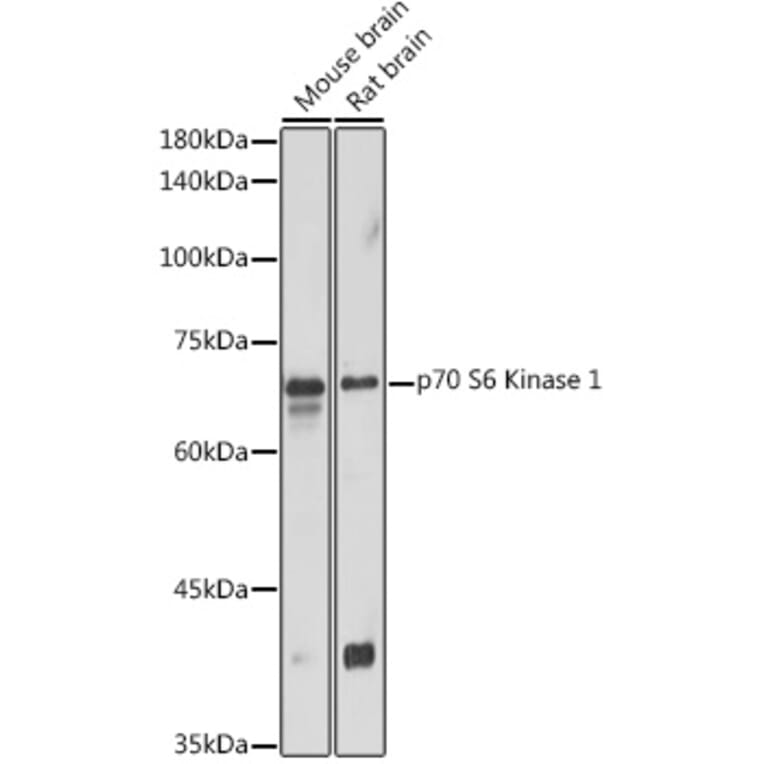 Western Blot - Anti-S6K1 Antibody (A90988) - Antibodies.com