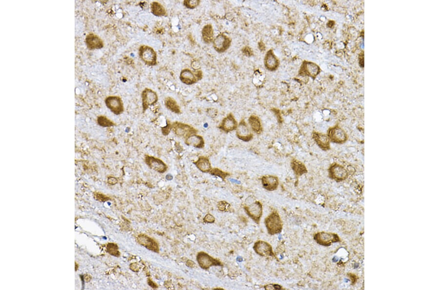 Immunohistochemistry - Anti-S6K1 Antibody (A90988) - Antibodies.com