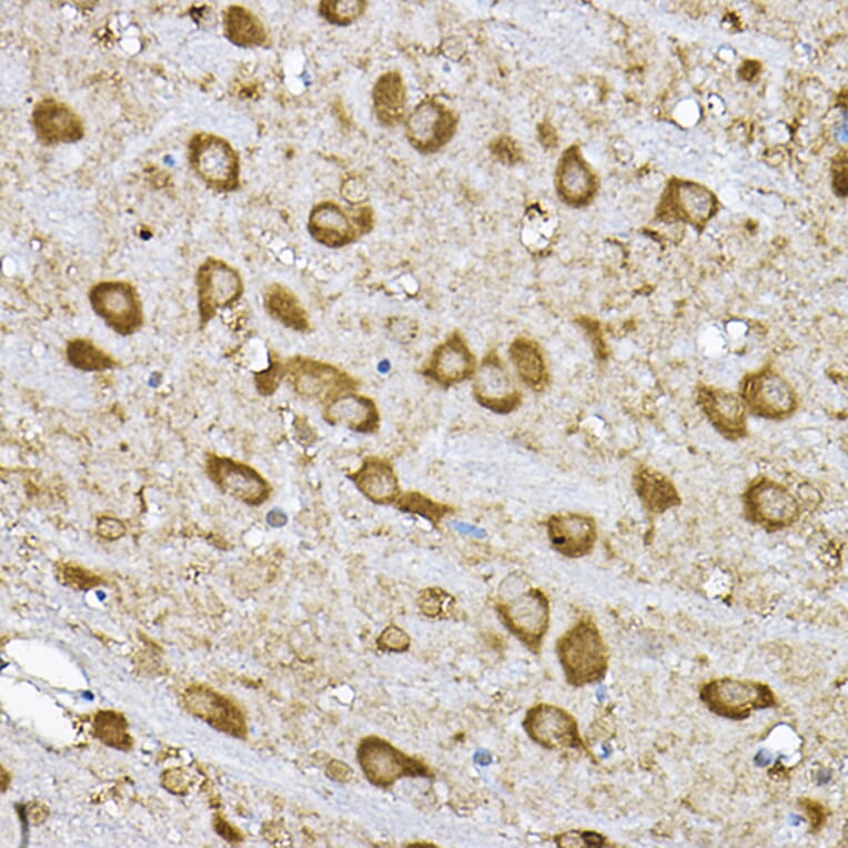 Immunohistochemistry - Anti-S6K1 Antibody (A90988) - Antibodies.com