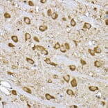 Immunohistochemistry - Anti-S6K1 Antibody (A90988) - Antibodies.com