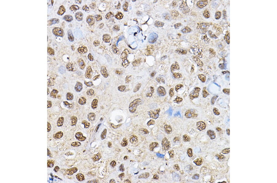 Immunohistochemistry - Anti-S6K1 Antibody (A90988) - Antibodies.com