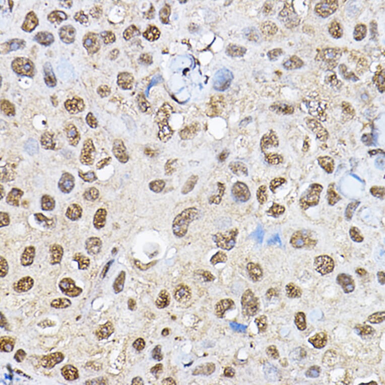 Immunohistochemistry - Anti-S6K1 Antibody (A90988) - Antibodies.com