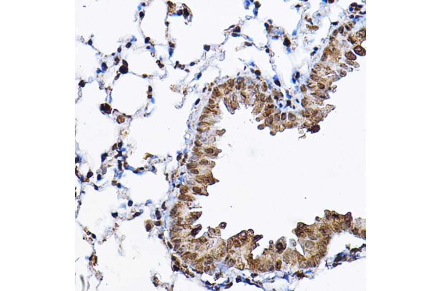 Immunohistochemistry - Anti-S6K1 Antibody (A90988) - Antibodies.com
