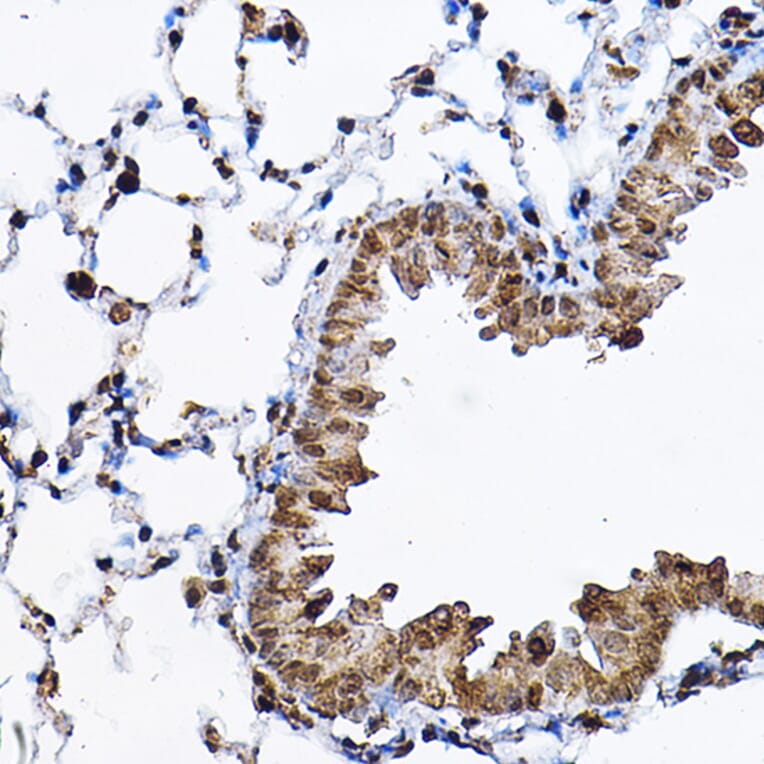 Immunohistochemistry - Anti-S6K1 Antibody (A90988) - Antibodies.com