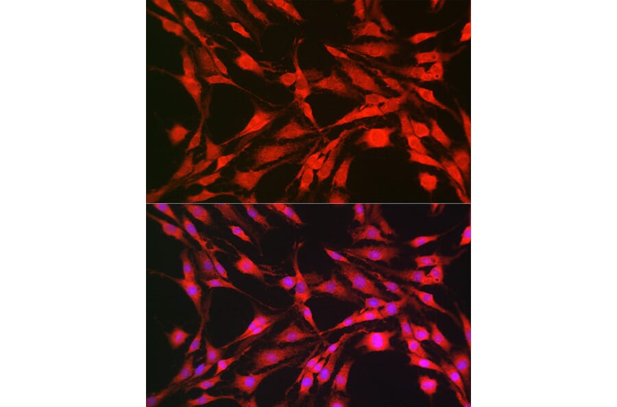 Immunofluorescence - Anti-S6K1 Antibody (A90988) - Antibodies.com