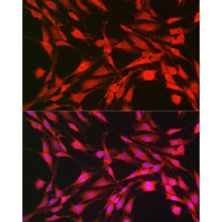 Immunofluorescence - Anti-S6K1 Antibody (A90988) - Antibodies.com