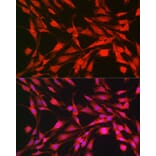 Immunofluorescence - Anti-S6K1 Antibody (A90988) - Antibodies.com