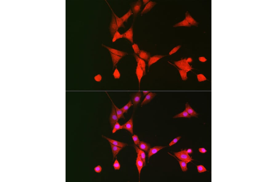 Immunofluorescence - Anti-S6K1 Antibody (A90988) - Antibodies.com
