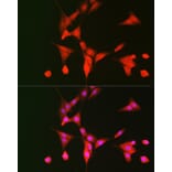 Immunofluorescence - Anti-S6K1 Antibody (A90988) - Antibodies.com