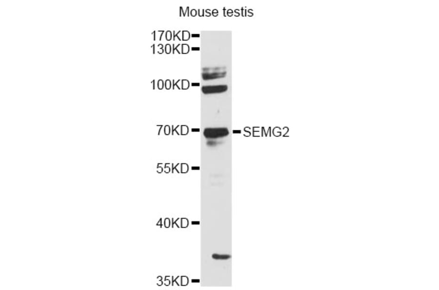 Western Blot - Anti-SEMG2 Antibody (A12878) - Antibodies.com