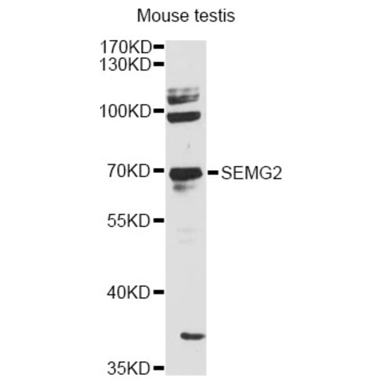 Western Blot - Anti-SEMG2 Antibody (A12878) - Antibodies.com