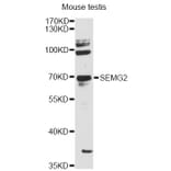 Western Blot - Anti-SEMG2 Antibody (A12878) - Antibodies.com