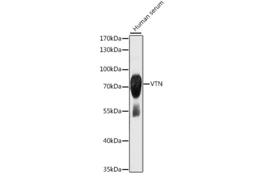 Western Blot - Anti-VTN Antibody (A13561) - Antibodies.com
