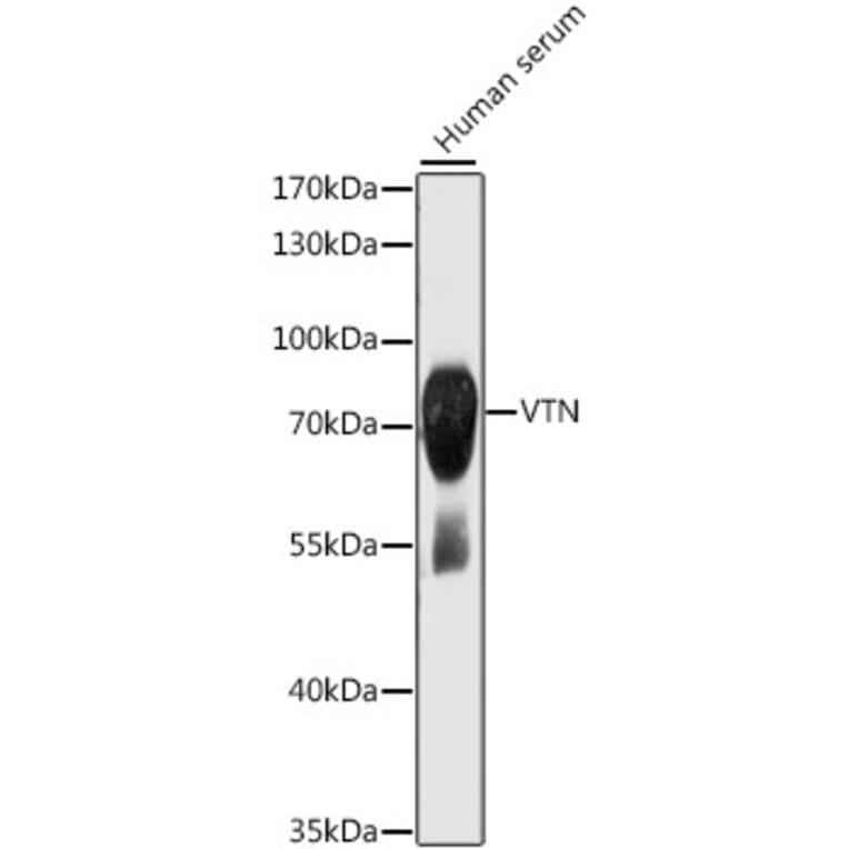 Western Blot - Anti-VTN Antibody (A13561) - Antibodies.com