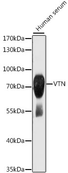 Western Blot - Anti-VTN Antibody (A13561) - Antibodies.com