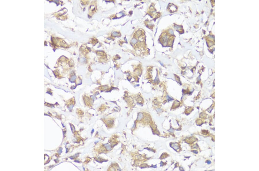 Immunohistochemistry - Anti-VTN Antibody (A13561) - Antibodies.com