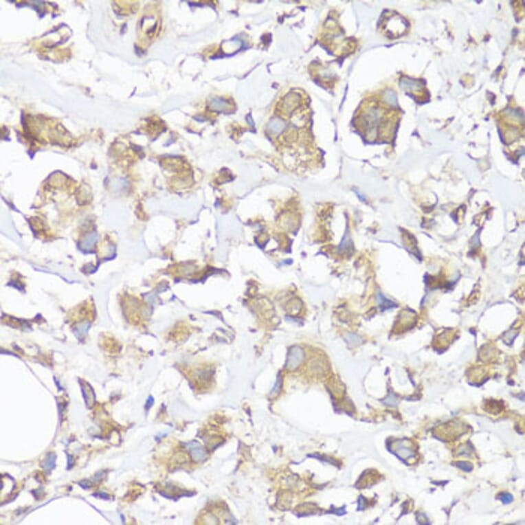 Immunohistochemistry - Anti-VTN Antibody (A13561) - Antibodies.com
