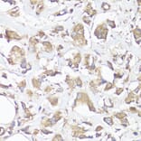 Immunohistochemistry - Anti-VTN Antibody (A13561) - Antibodies.com
