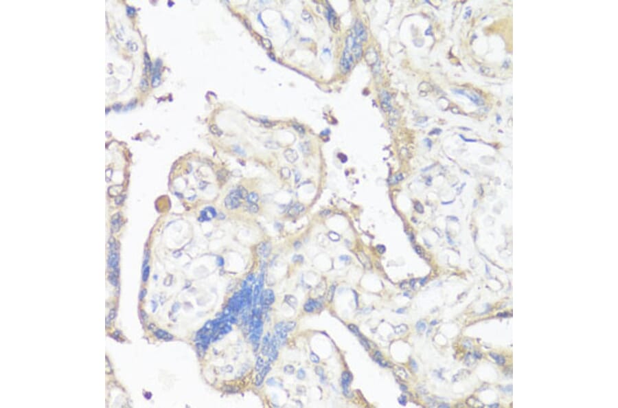 Immunohistochemistry - Anti-VTN Antibody (A13561) - Antibodies.com