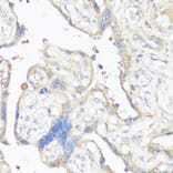 Immunohistochemistry - Anti-VTN Antibody (A13561) - Antibodies.com