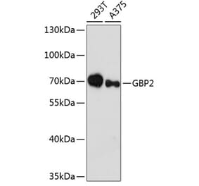 Western Blot - Anti-GBP2 Antibody (A90991) - Antibodies.com