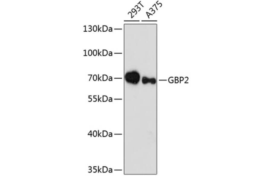 Western Blot - Anti-GBP2 Antibody (A90991) - Antibodies.com
