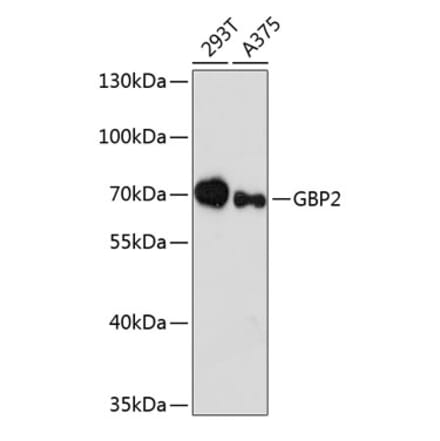 Western Blot - Anti-GBP2 Antibody (A90991) - Antibodies.com