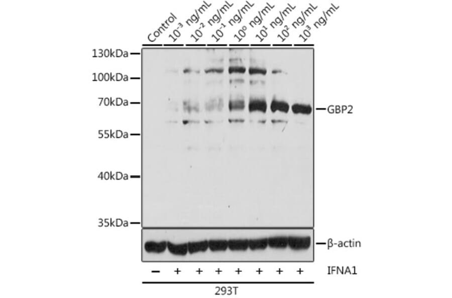 Western Blot - Anti-GBP2 Antibody (A90991) - Antibodies.com