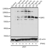 Western Blot - Anti-GBP2 Antibody (A90991) - Antibodies.com