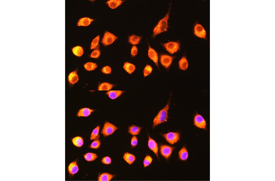 Immunofluorescence - Anti-GBP2 Antibody (A90991) - Antibodies.com