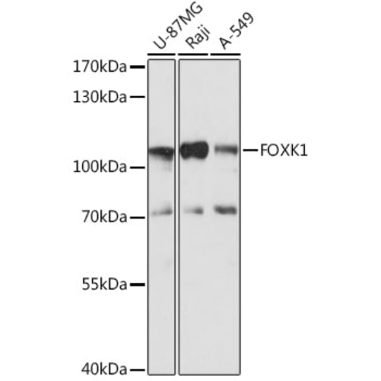 Western Blot - Anti-FOXK1/MNF Antibody (A90992) - Antibodies.com