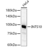 Western Blot - Anti-INTS10 Antibody (A90993) - Antibodies.com