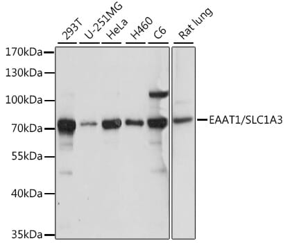 Western blot analysis of extracts of various cell lines, using Anti-SLC1A3 Antibody (A15722) at 1:1,000 dilution.
Secondary antibody: Goat Anti-Rabbit IgG (H+L) (HRP) (AS014) at 1:10,000 dilution.
Lysates / proteins: 25µg per lane.
Blocking buffer: 3% non-fat dry milk in TBST.
Detection: ECL Basic Kit (RM00020).
Exposure time: 10s.