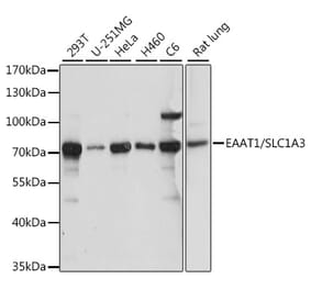 Western Blot - Anti-EAAT1 Antibody (A90994) - Antibodies.com