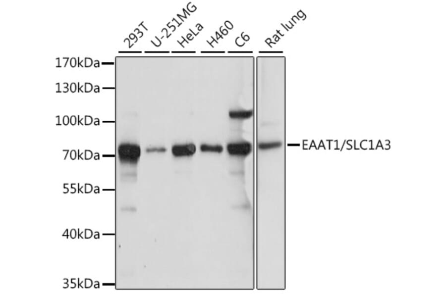 Western Blot - Anti-EAAT1 Antibody (A90994) - Antibodies.com