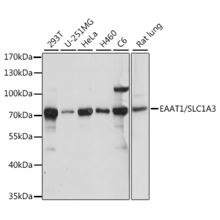 Western Blot - Anti-EAAT1 Antibody (A90994) - Antibodies.com