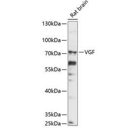 Western Blot - Anti-VGF Antibody (A90995) - Antibodies.com