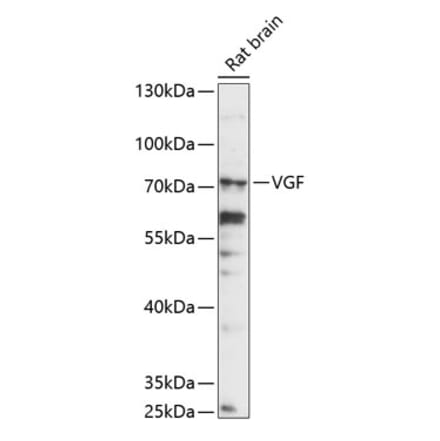 Western Blot - Anti-VGF Antibody (A90995) - Antibodies.com