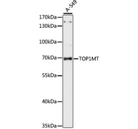 Western Blot - Anti-TOP1MT Antibody (A90996) - Antibodies.com