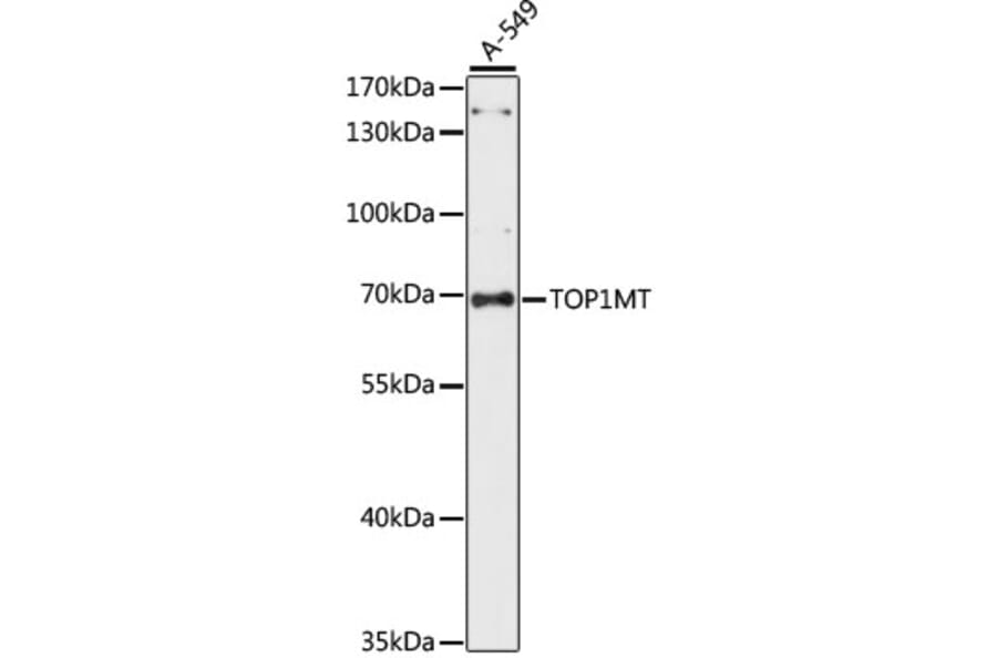 Western Blot - Anti-TOP1MT Antibody (A90996) - Antibodies.com