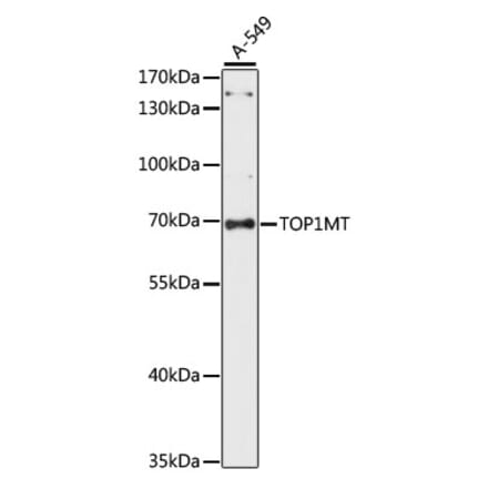Western Blot - Anti-TOP1MT Antibody (A90996) - Antibodies.com