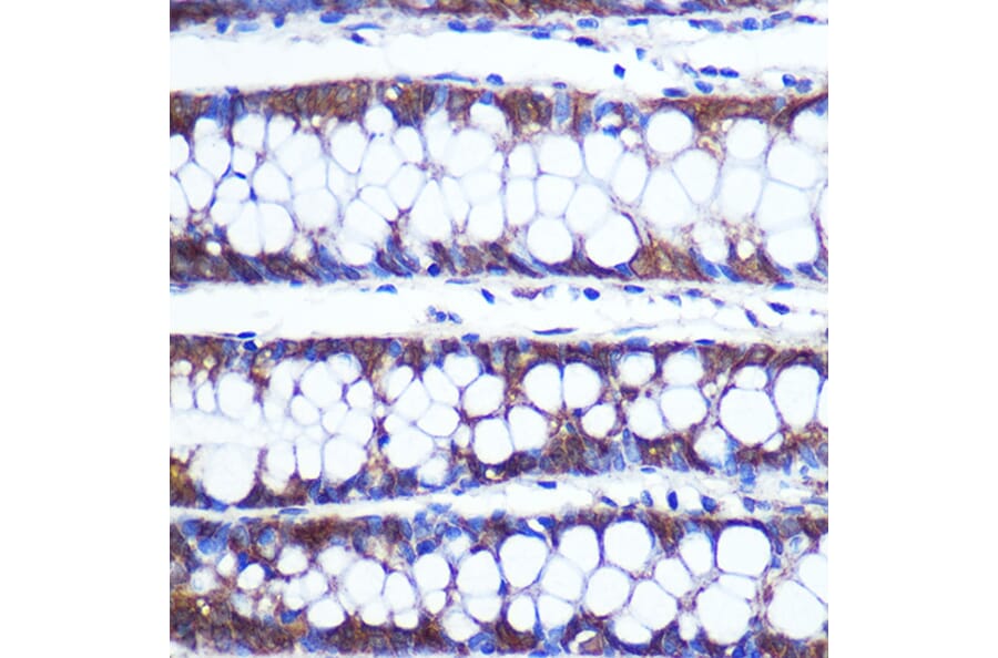 Immunohistochemistry - Anti-TOP1MT Antibody (A90996) - Antibodies.com