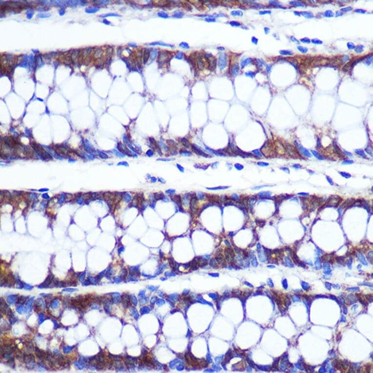 Immunohistochemistry - Anti-TOP1MT Antibody (A90996) - Antibodies.com