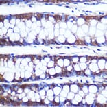 Immunohistochemistry - Anti-TOP1MT Antibody (A90996) - Antibodies.com