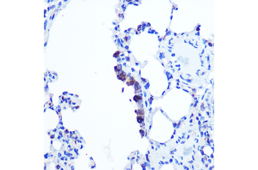 Immunohistochemistry - Anti-TOP1MT Antibody (A90996) - Antibodies.com