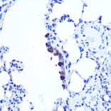 Immunohistochemistry - Anti-TOP1MT Antibody (A90996) - Antibodies.com